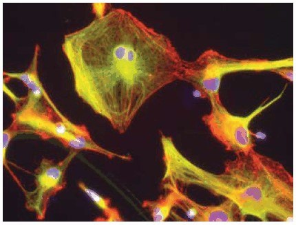 This image shows cells derived from the culture of neural stem cells grown in the presence of EGF (<a href="/product/sigma/e9644">E9644</a>) and LIF (<a href="/product/sigma/l5283">L5283</a>). The cells were expanded in neural stem cell expansion medium (<a href="/product/sigma/s3194">S3194</a>) and then moved to conditions to allow them to differentiate. Differentiated cells were fixed and stained with an antibody for GFAP (an astrocyte marker in green, Product Number <a href="/product/sigma/g9269">G9269</a>). Actin is labeled with TRITC phalloidin (<a href="/product/sigma/p1951">P1951</a>) and the nuclei are labeled with DAPI (<a href="/product/sigma/d8417">D8417</a>). Neural stem cell differentiation