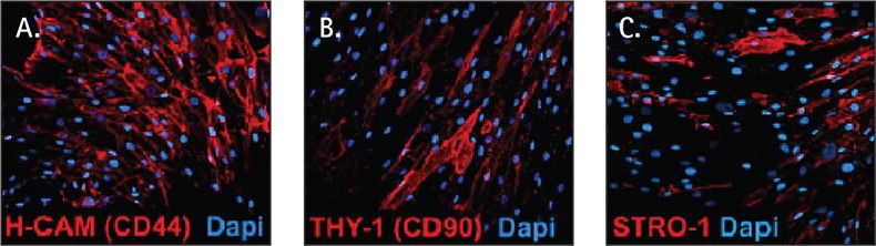 Mesenchymal Stem Cell Culture Human mesenchymal stem cell markers