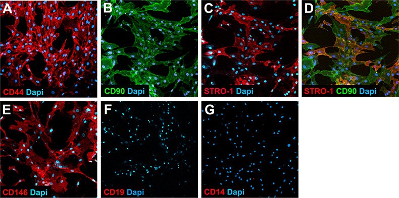 Mesenchymal Stem Cell Culture Immunocytochemical staining of cultured human bone marrow-derived mesenchymal stem cells stained