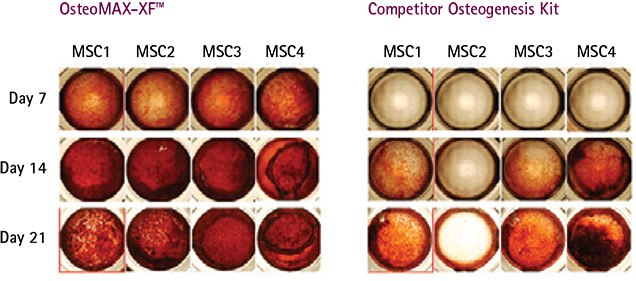 Mesenchymal Stem Cell Culture Mineralization kinetics of human bone-marrow derived MSC