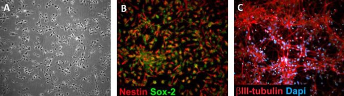 A,B) Human iPSC derived neural stem cells grown in monolayer cultures express stem cell markers Nestin and Sox-2. C) NSCs can be further differentiated into b-III-tubulin positive neurons. Human iPSC derived neural stem cells