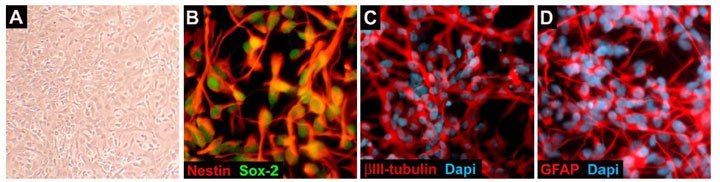 Both ReNcell® VM and CX human neural progenitors are grown as monolayers (A) and express NSC markers, Nestin (B, Red) and Sox-2 (B, Green). ReNcell® CX cells are able to differentiate into neurons expressing βIII-tubulin (C; Red) and glial cells expressing GFAP (D; Red). Dapi nuclear counterstain in Blue. ReNcell VM Human Neural Progenitors