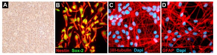 ReNcell® VM Human Neural Progenitors ReNcell CX Human Neural Progenitors