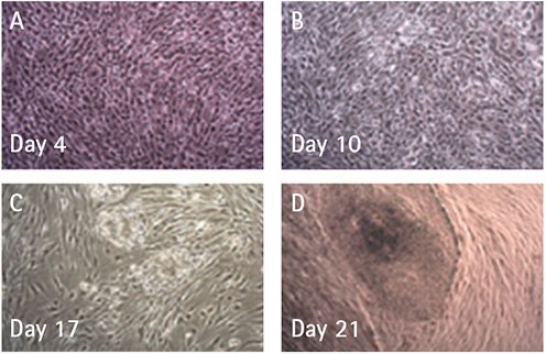 Colonies of Human iPSCs Brightfield microscopy shows HFFs being reprogrammed over a 21 day time period using a single transfection of Simplicon™ Reprogramming RNA. After 10 days of puromycin selection and replating on fresh PMEF cells, colonies started to emerge at day 17-21.