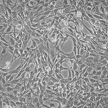 Hematopoietic Stem and Immune Cell Culture Stromal Cells for T-Cell Differentiation