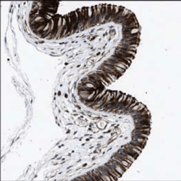 Immunohistochemical staining of human nasopharynx shows cytoplasmic and membranous positivity in respiratory epithelial cells using Prestige Antibodies<sup>®</sup> Anti-DEFA5 (Cat. No. HPA015775). Immunohistochemical staining of human nasopharynx shows cytoplasmic and membranous positivity in respiratory epithelial cells using Prestige Antibodies® Anti-DEFA5 (Cat. No. HPA015775)