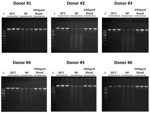 Long-term Storage of Blood in DNAgard® Blood DNA integrity in blood after 12 months of storage at room temperature (22 - 25 °C).
