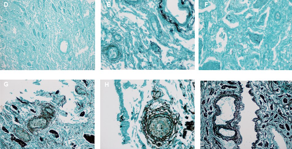 Impact of water impurities on GMS staining Micrographs of GMS staining with various water contaminants