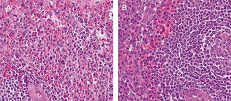 Micrographs of tonsil tissue stained with Hematoxylin and Eosin Micrographs of tonsil tissue stained with Hematoxylin and Eosin