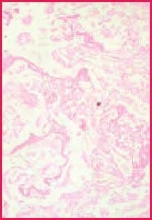 Positive fungus control A close-up view of a pinkish cellular structure of positive fungus control. PAS stain, 400X