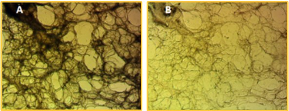 Visikol® HISTO™ and HISTO-M™ Tissue Clearing Reagents Precision cut lung slice before (left) and after (right) subjected