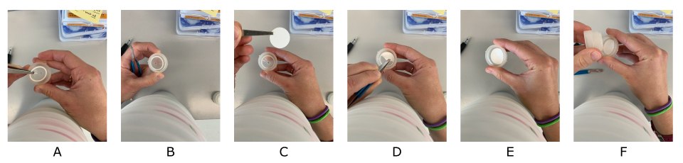 Fotos secuenciales que muestran el montaje de los filtros Swinnex®. La primera foto muestra la utilizaci&oacute;n de pinzas para quitar la junta y la junta t&oacute;rica. Las tres fotos siguientes muestran la colocaci&oacute;n del filtro en el dispositivo utilizando pinzas. Las dos &uacute;ltimas fotos muestran la sustituci&oacute;n de la junta y el ajuste del portafiltros.