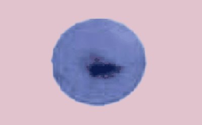 Oxidase Test Pseudomonas Fluorescens The oxidase test shows positive result for P. aeruginosa. This is because when the electron donor is oxidized by cytochrome oxidase enzyme it turns a dark purple.