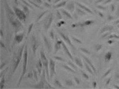Sanger gRNA Application Data - Cells Infected with virus Cell growth after puromycin selection for four days - Infected with Virus