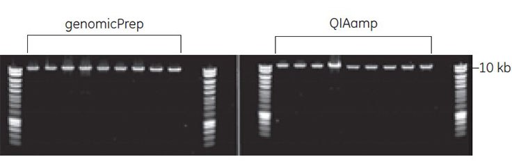 Amplification of an 11 kb amplicon from purified bacterial genomic DNA. Five microliters of the eluted genomic DNA solution, corresponding to 50 to 150 ng of the genomic DNA, was used per reaction. Following PCR, equal volumes from each reaction were resolved on a 0.8% agarose gel stained with ethidium bromide. M = 1 kb molecular weight marker Amplification of an 11 kb amplicon from purified bacterial genomic DNA