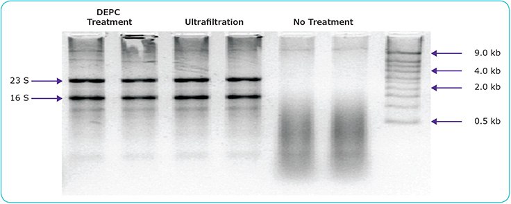 gel-electrophoresis-of-rrna-in-water Gel electrophoresis of rRNA in water previously spiked with RNase and either DEPC-treated, ultrafiltered, or left untreated