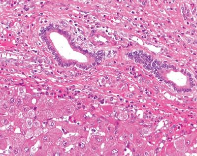 Hematoxylin Eosin Microscopic section showing formalin-fixed, paraffin-embedded (FFPE) liver tissue stained in red and purple with Hematoxylin and eosin (H&E) solution