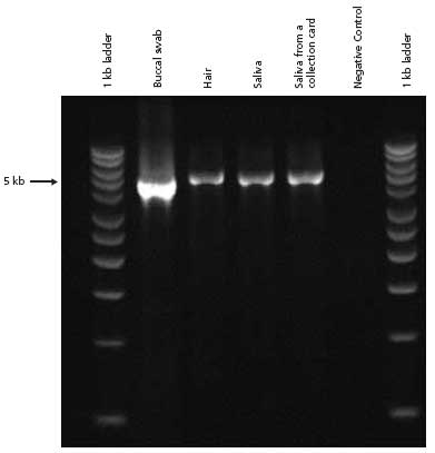 Extract-N-Amp™ Tissue Feature Article PCR analysis of genomic DNA extracted from various types of human tissue and amplified with 5 kb β-Globin primers