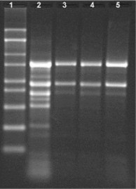 Spectrum™ Plant Total RNA Kit Total RNA extracted from 100 mg of Jatropha tissue