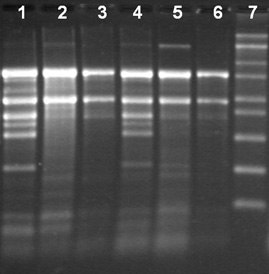 Spectrum™ Plant Total RNA Kit Total RNA Isolation from different tissue types of tobacco using the Spectrum™ Total RNA kit