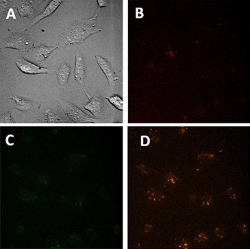 Microscopic images of control cells Microscopic images of control cells (treated only with transfection reagent).