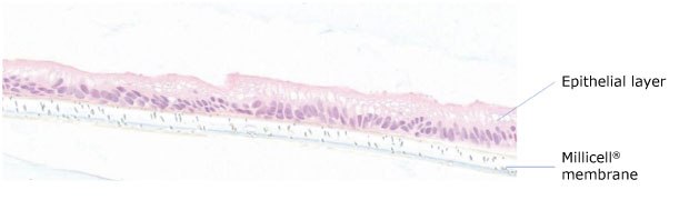 Histogram of Duo87 organoid cross-section