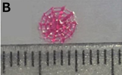 3D printed Spider web An actual 3D printed pink colored Spider web made for the HCSG breast cancer model kept next to a measuring scale, showing its diameter of 0.5 cm.