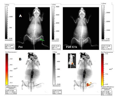 In vivo planar X-ray images (exposure time 30 s) of a mouse prior to (a) and 12 h post intratumoral injection of indocyanine green-loaded silica-coated gold nanorods (200 μL, 1.5 mg/mL). (b) An in vivo planar X-ray image using a 60 s exposure time (left) taken 12 h post intratumoral injection of the dual mode imaging contrast agent was overlapped with the homologous near-infrared fluorescence image (10 s exposure time) (right). Inset: the corresponding overlay of bright field and near-infrared fluorescent images. The green arrow indicates the tumor. The thin layer of silica sandwiched between the gold nanorod and indocyanine green chromophores protected the dye from fluorescent quenching. (Source: Reprinted with permission from Optics Express, Vol. 19, Issue 18, pp. 17030-17039, 2011) In vivo planar X-ray images