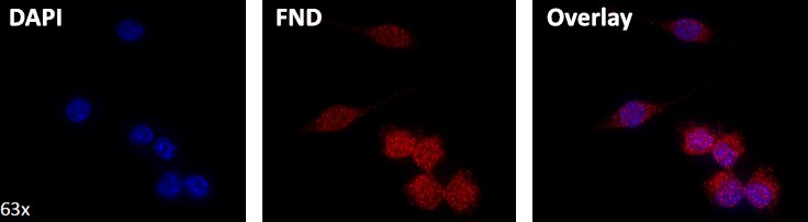 Streptavidin functionalized 40 nm fluorescent nanodiamond containing NV centers (~2 ppm) targeting a biotinylated intracellular target, with comparison and overlay to DAPI (4’,6-diamidino-2-phenylindole) stained nuclei. Image courtesy of Dr. Lindsay Parker, ARC Centre of Excellence in Nanoscale Biophotonics, Department of Chemistry and Biomolecular Sciences, Macquarie University, Sydney, Australia. Streptavidin functionalized 40 nm fluorescent nanodiamond containing NV centers (~2 ppm) targeting a biotinylated intracellular target, with comparison and overlay to DAPI (4’,6-diamidino-2-phenylindole) stained nuclei.