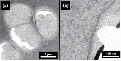 ALD — A Versatile Tool for Nanostructuring TEM (200 kV) images of ferritin molecules treated