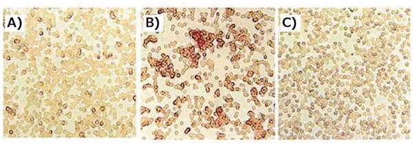 Incorporation of transferrin decreases erythrocyte aggregation. Fresh murine erythrocytes were incubated with PEI/DNA or Tf-PEI/PEI/DNA complexes (N/P = 4.8) for 1 h at 37 °C. A) Tf-PEI/PEI/ DNA, B) PEI/DNA, C) control. Adapted with permission from Kircheis et al.2 Copyright 2002 Nature Publishing Group. Incorporation of transferrin decreases erythrocyte aggregation