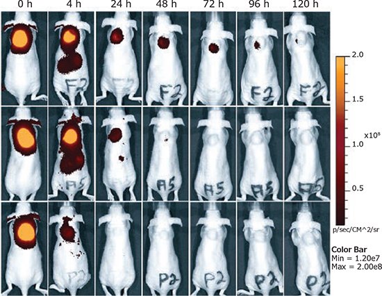 Intratumoral injection of siRNA polyplexes. Retention of targeted polyplexes at the tumor site determined by NIR fluorescence bioimaging. Folic acid-targeted polyplexes (top), untargeted polyplexes (center), and equal amounts (25 μg) of free Cy7-labeled siRNA (bottom). Adapted with permission of Dohmen et al.19 Copyright 2012 American Chemical Society Intratumoral injection of siRNA polyplexes