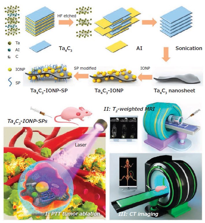 Schematic illustration of the fabrication process of Ta4C3-IONP-SPs Schematic illustration of the fabrication process of Ta4C3-IONP-SPs