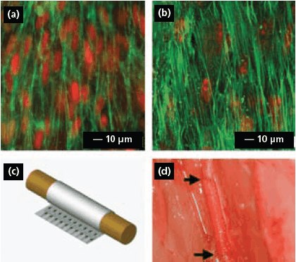 配向型PLLAナノ繊維の表面に植え込まれたヒト大動脈SMCおよび骨髄MSCの共焦点顕微鏡写真