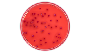 Escherichia Coli Escherichia Coli