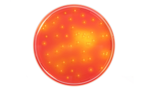 Staphylococcus Aureus Staphylococcus Aureus