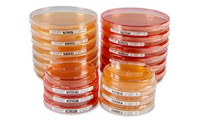ICR Contact and Settle Plates A close-up view of multiple petri dishes in various sizes, some stacked and others placed separately, all labeled, demonstrating a variety of cultured media in a laboratory setting.