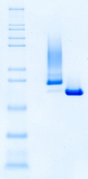 Identity and purity of Benzonase® Salt Tolerant Endonuclease and competitor A as shown by non-reducing SDS-PAGE La endonucleasa tolerante a la sal Benzonase® exhibe una mejor identidad y pureza que la competidora A utilizando SDS-PAGE reductora.