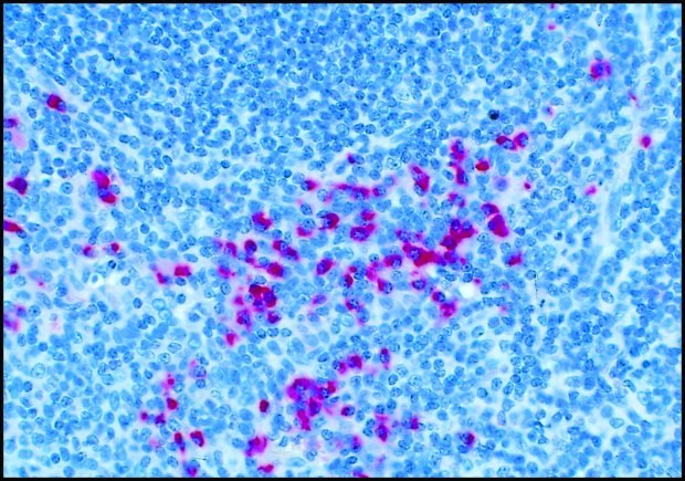 Anti-Human IgG (gamma-chain specific)-Alkaline Phosphatase Conjugate Formalin-fixed, paraffin-embedded section of human tonsil stained with Anti-Human IgG (gamma -chain specific)-Alkaline Phosphatase Conjugate, F(ab)2 fragment of goat antibody (Cat. No. A3312) using SIGMA FAST™ Fast Red TR/Naphthol AS-MX Tablets (Cat. No. F4523) as substrate.