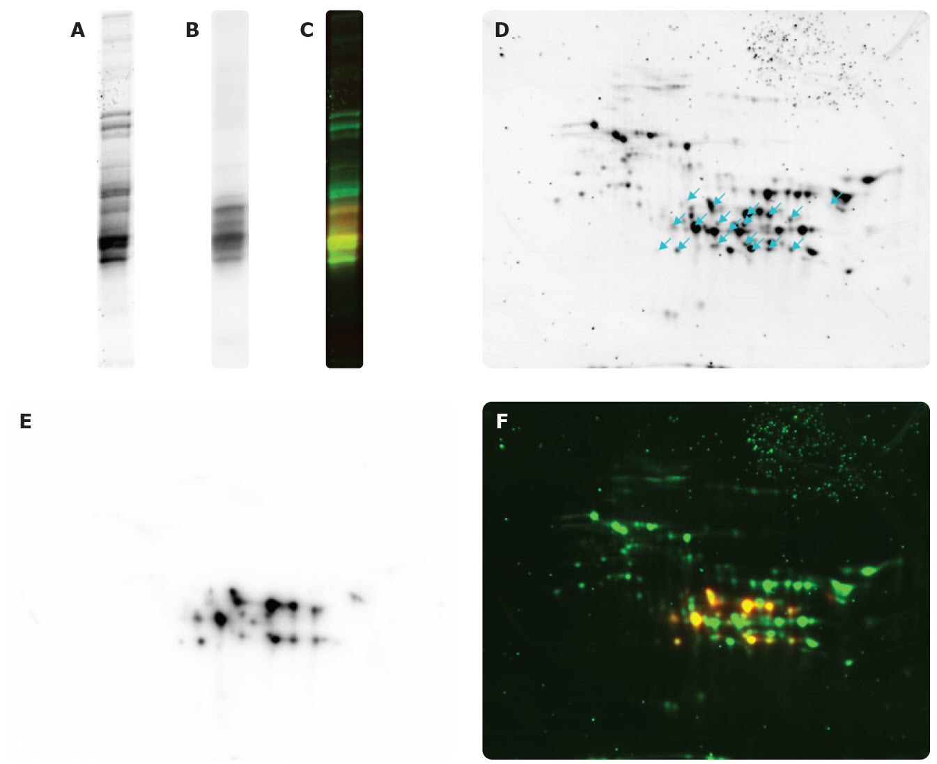 2-D Western Blotting Inmunoelectrotransferencia 2-D.