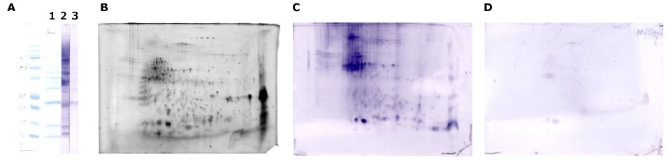 Immunodetection Buckwheat The Auto2D system for buckwheat-allergic patient serum separation and immunodetection.