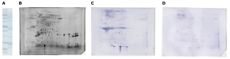 Separation Walnut Protein Extract The Auto2D system for walnut allergy patient serum separation and immunodetection