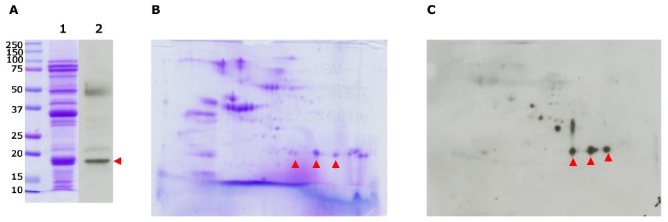 Soybean Extract Immunodetection Separation and immunodetection of soybean allergens using our Auto2D® system.