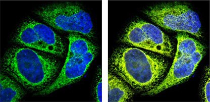 Anti-HSP90B1 (HPA003901) staining is shown in green, nuclear reference DAPI in blue and the endoplasmic reticulum (ER) reference marker detecting calreticulin shown in yellow. The yellow signal overlaps with the green antibody signal, confirming ER-specificity. Organelle Markers in Subcellular Localization Studies