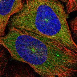 Anti-KIF5B antibody shows localization to cytosol and microtubule organizing center using IF staining. Anti-KIF5B antibody shows localization to cytosol and microtubule organizing center using IF staining.