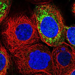 Anti-MRPS7 antibody stained in green showing single cell variation in A-431 cell line. Anti-MRPS7 antibody stained in green showing single cell variation in A-431 cell line.