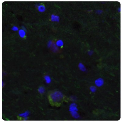 Human Normal Cortex IHC-IF Staining with Anti-SALL4 and Anti-PTEN Antibodies Multiplexed IHC-IF staining of human normal cortex samples using Anti-SALL4 monoclonal (Product No. AMAb91769) and Anti-PTEN monoclonal (Product No. AMAb91736) antibodies.