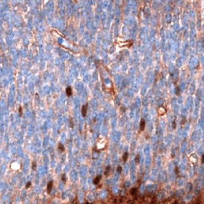 IHC Staining of Developing Mouse Brain Cells Using Anti-SALL4 Monoclonal Antibody Immunohistochemical staining of developing brain cells in mouse embryo E11 using Anti-SALL4 monoclonal antibody (Product No. AMAb91769) showing nuclear positivity.