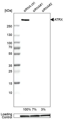 Genetic validation Genetic validation