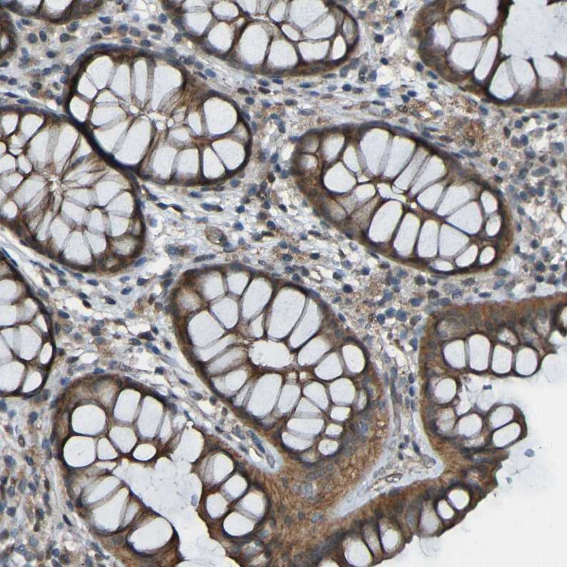 Anti-LGR5/GPR49 Antibody Immunohistochemical staining of human colon with anti-LGR5/GPCR49 polyclonal antibody (Cat. No. HPA012530) shows cytoplasmic positivity in glandular cells, in brown.